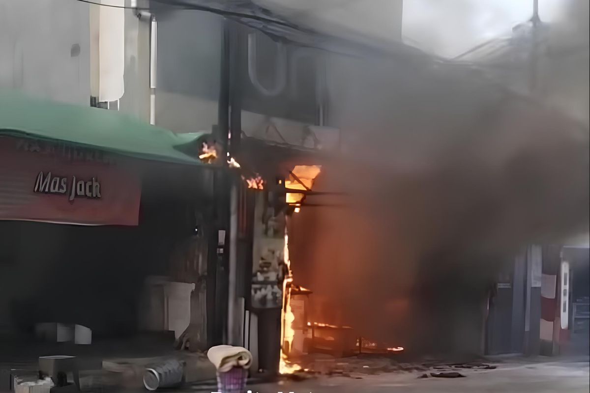 Luka Bakar dan Perjuangan Pemulihan
