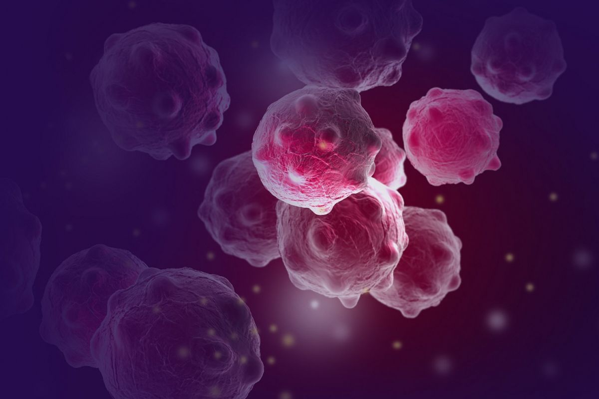 Daging Merah Picu Kanker Payudara? Cek Fakta dan Mitosnya Sekarang!