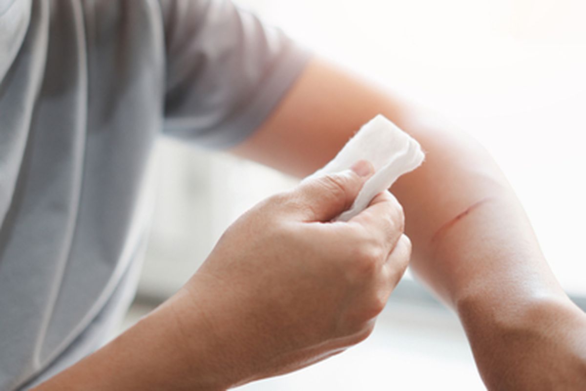 3 Tips Ampuh Merawat Luka Ringan agar Cepat Kering dan Sembuh dari Dokter