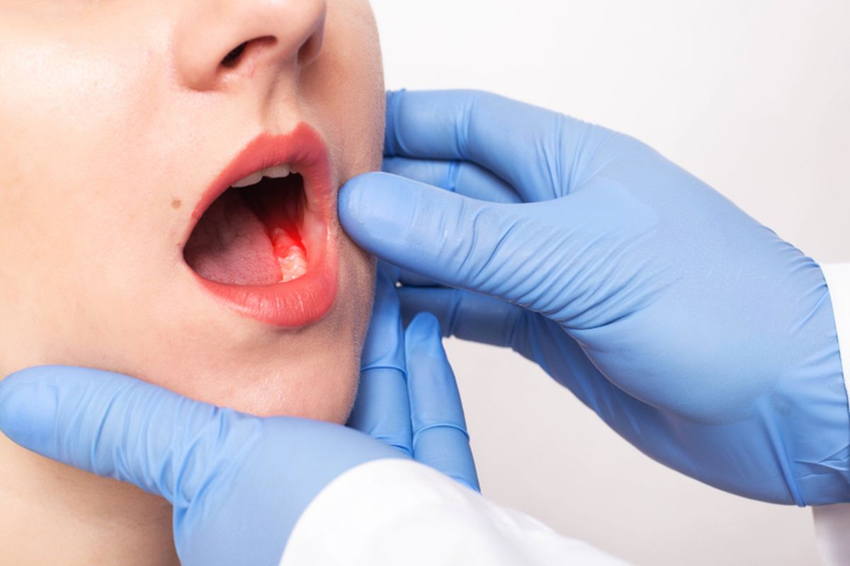 2 Masalah Kesehatan Gusi yang Sering Diabaikan, Bisa Jadi Silent Killer!